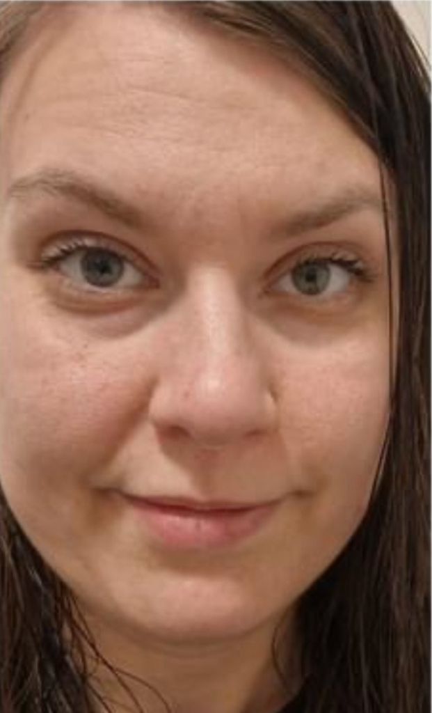 Heidi før forløbet